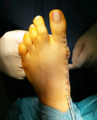 Operative Therapien