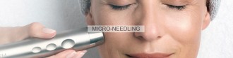 Micro-Needling - Die kleinste Geheim­waffe der Welt