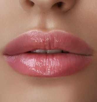 ANTI-AGING - HYALURON - LIPPENUNTERSPRITZUNG - JETPEEL™